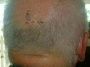 bald_mowing.jpg